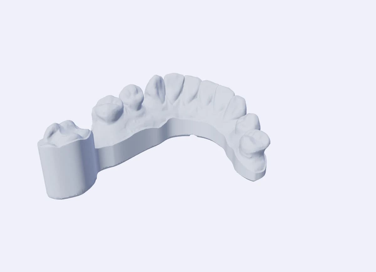 The same scan after automatic artefact trimming, with a smooth bevelled model base